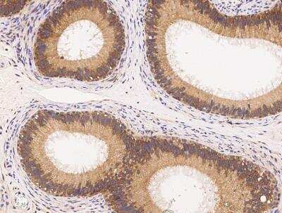 Immunohistochemistry-Paraffin: IRE1 alpha Antibody (10B2B2) [NBP3-05787]