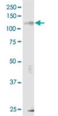 Western Blot: IRE1 alpha Antibody (8D12) [H00002081-M02]