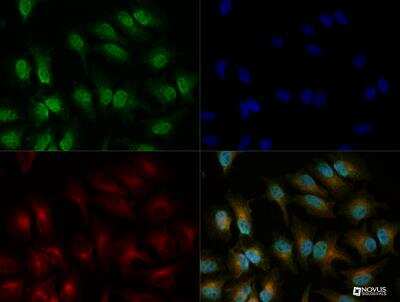 Immunocytochemistry/ Immunofluorescence: IRE1 alpha Antibody [NB100-2324]