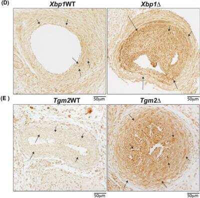 Immunohistochemistry: IRE1 alpha Antibody [NB100-2324]