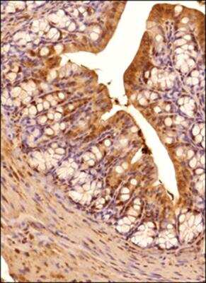 Immunohistochemistry-Paraffin: IRE1 alpha Antibody [NB100-2324]