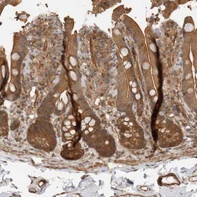 Immunohistochemistry-Paraffin: IRE1 alpha Antibody [NBP2-54680]