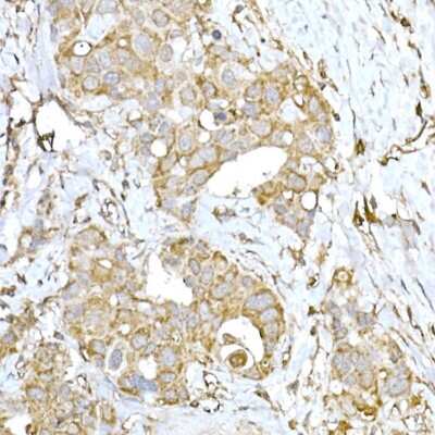 Immunohistochemistry-Paraffin: IRE1 alpha Antibody - Azide and BSA Free [NBP2-95252]
