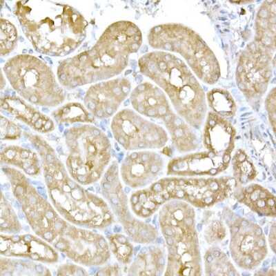 Immunohistochemistry-Paraffin: IRE1 alpha Antibody - Azide and BSA Free [NBP2-95252]