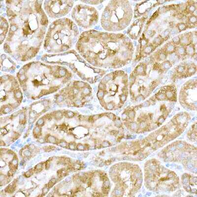 Immunohistochemistry-Paraffin: IRE1 alpha Antibody - Azide and BSA Free [NBP2-95252]