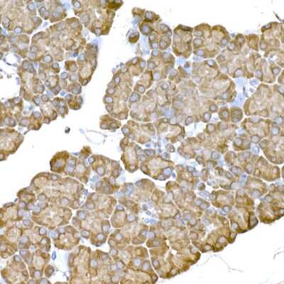 Immunohistochemistry-Paraffin: IRE1 alpha Antibody - Azide and BSA Free [NBP2-95252]