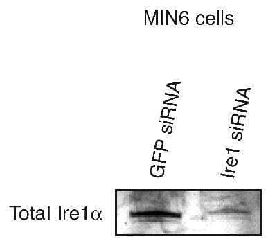 Knockdown Validated: IRE1 alpha Antibody Pack [NBP2-50067]
