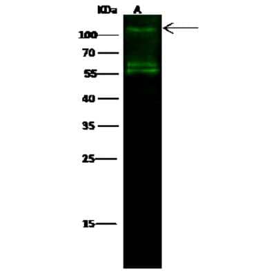 Western Blot: IRE1 alpha Antibody [NBP2-99902]