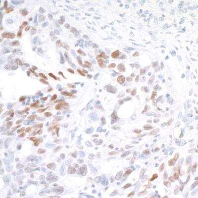 Immunohistochemistry: IRF1 Antibody (BLR039F) [NBP2-76419]