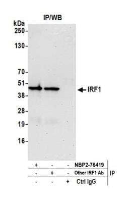 Immunoprecipitation: IRF1 Antibody (BLR039F) [NBP2-76419]