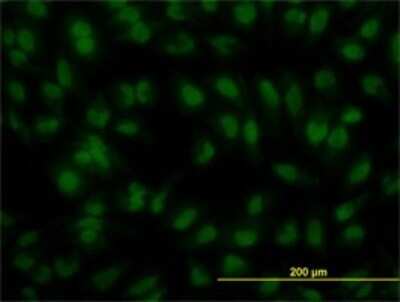Immunocytochemistry/ Immunofluorescence: IRF2 Antibody (3B5) [H00003660-M02]