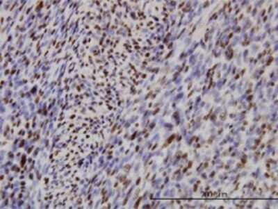 Immunohistochemistry-Paraffin: IRF2 Antibody (3B5) [H00003660-M02]