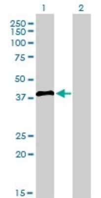 Western Blot: IRF2 Antibody (3B5) [H00003660-M02]