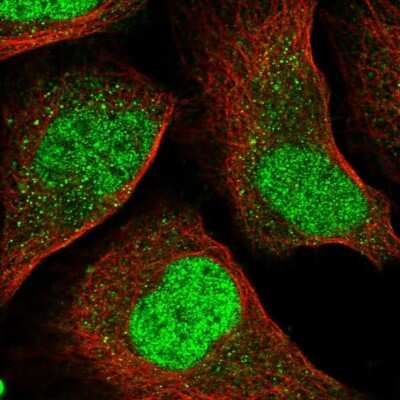 Immunocytochemistry/ Immunofluorescence: IRF2 Antibody [NBP1-89433]