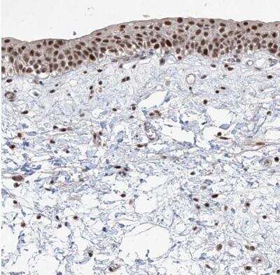 Immunohistochemistry-Paraffin: IRF2 Antibody [NBP1-89433]