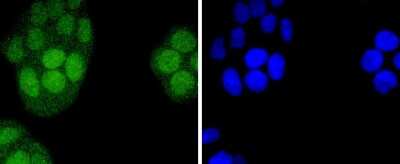 Immunocytochemistry/ Immunofluorescence: IRF2 Antibody (JJ088-0) [NBP2-67870]