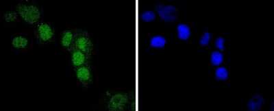 Immunocytochemistry/ Immunofluorescence: IRF2 Antibody (JJ088-0) [NBP2-67870]