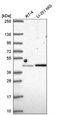 Western Blot: IRF2 Antibody [NBP2-56712]