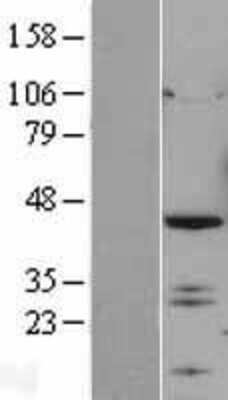 Western Blot: IRF2 Overexpression Lysate [NBL1-12031]