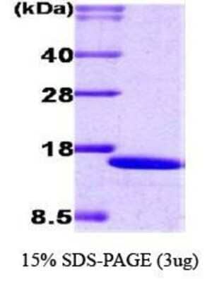 SDS-PAGE: Recombinant Human IRF2 His Protein [NBC1-18476]