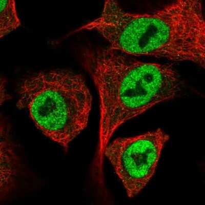 Immunocytochemistry/ Immunofluorescence: IRF2BP1 Antibody [NBP2-58542]