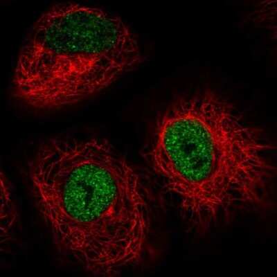 Immunocytochemistry/ Immunofluorescence: IRF2BP2 Antibody [NBP2-56551]