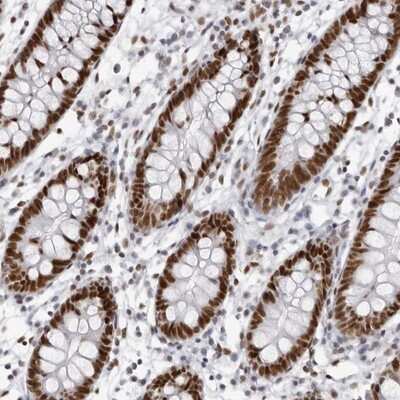 Immunohistochemistry-Paraffin: IRF2BP2 Antibody [NBP1-93674]