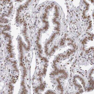 Immunohistochemistry-Paraffin: IRF2BP2 Antibody [NBP1-93674]
