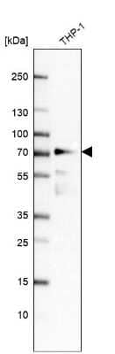 Western Blot: IRF2BP2 Antibody [NBP1-93674]