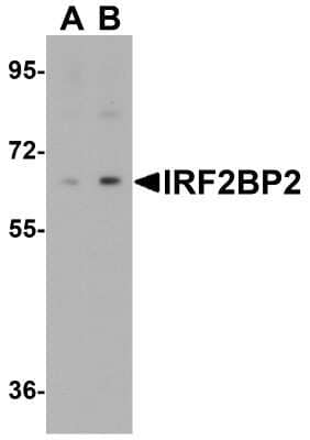 Western Blot: IRF2BP2 AntibodyBSA Free [NBP2-81996]