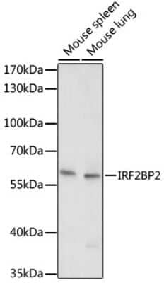 Western Blot: IRF2BP2 AntibodyAzide and BSA Free [NBP2-94463]