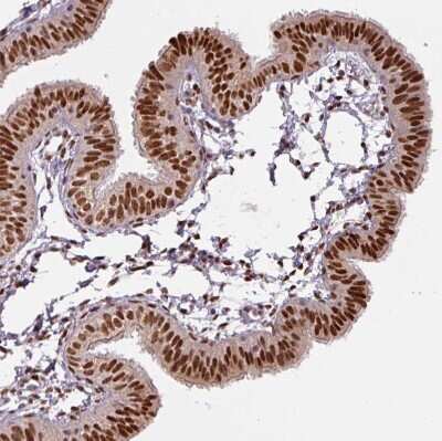 Immunohistochemistry-Paraffin: IRF2BPL Antibody [NBP2-14712]