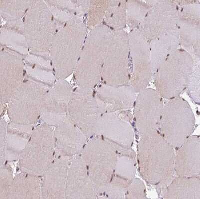 Immunohistochemistry-Paraffin: IRF2BPL Antibody [NBP2-14712]