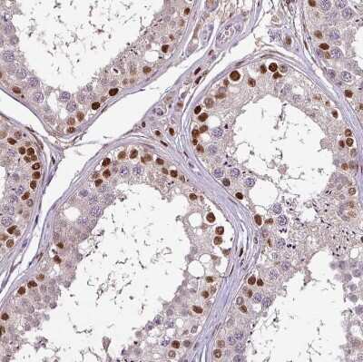 Immunohistochemistry-Paraffin: IRF2BPL Antibody [NBP2-14712]
