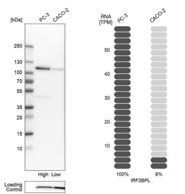 Western Blot: IRF2BPL Antibody [NBP2-14712]