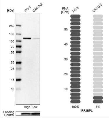 Western Blot: IRF2BPL Antibody [NBP2-56241]