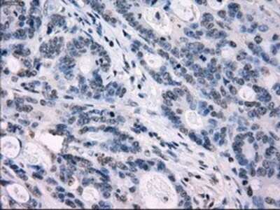 Immunohistochemistry: IRF3 Antibody (OTI2G3) - Azide and BSA Free [NBP2-71042]