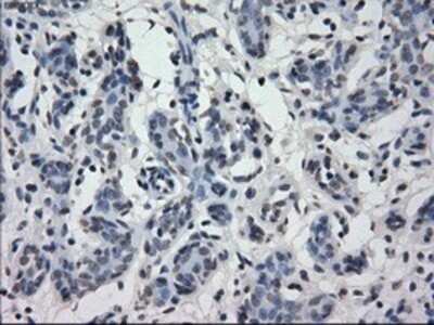 Immunohistochemistry: IRF3 Antibody (OTI2G3) - Azide and BSA Free [NBP2-71042]