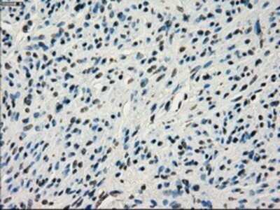 Immunohistochemistry: IRF3 Antibody (OTI2G3) - Azide and BSA Free [NBP2-71042]