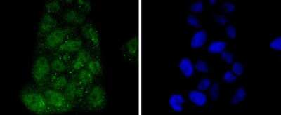 Immunocytochemistry/ Immunofluorescence: IRF3 Antibody (SD2062) [NBP2-67741]