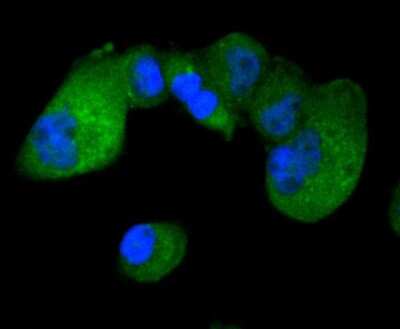 Immunocytochemistry/ Immunofluorescence: IRF3 Antibody (SD2062) [NBP2-67741]