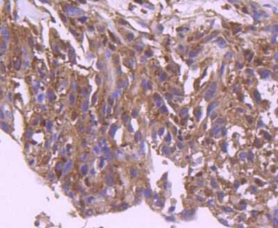 Immunohistochemistry-Paraffin: IRF3 Antibody (SD2062) [NBP2-67741]