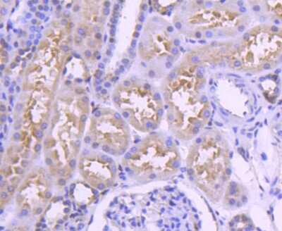 Immunohistochemistry-Paraffin: IRF3 Antibody (SD2062) [NBP2-67741]