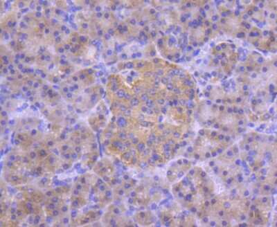 Immunohistochemistry-Paraffin: IRF3 Antibody (SD2062) [NBP2-67741]