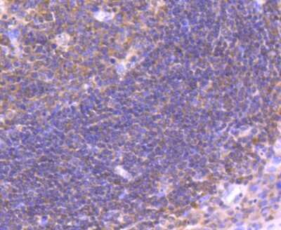 Immunohistochemistry-Paraffin: IRF3 Antibody (SD2062) [NBP2-67741]