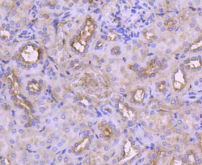 Immunohistochemistry-Paraffin: IRF3 Antibody (SD2062) [NBP2-67741]