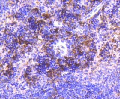 Immunohistochemistry-Paraffin: IRF3 Antibody (SD2062) [NBP2-67741]
