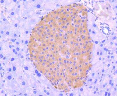 Immunohistochemistry-Paraffin: IRF3 Antibody (SD2062) [NBP2-67741]
