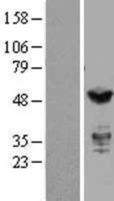 Western Blot: IRF3 Overexpression Lysate [NBL1-12032]