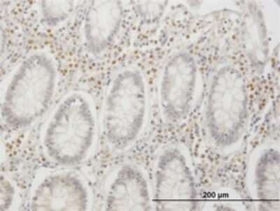 Immunohistochemistry-Paraffin: IRF4 Antibody (2F2) [H00003662-M02]